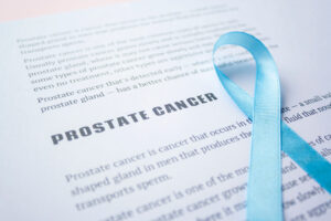 前立腺がんのステージや初期症状・治療法などを解説