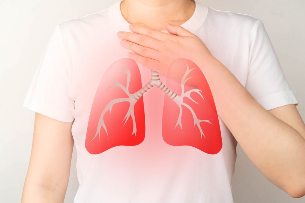 肺がんのステージ別の症状