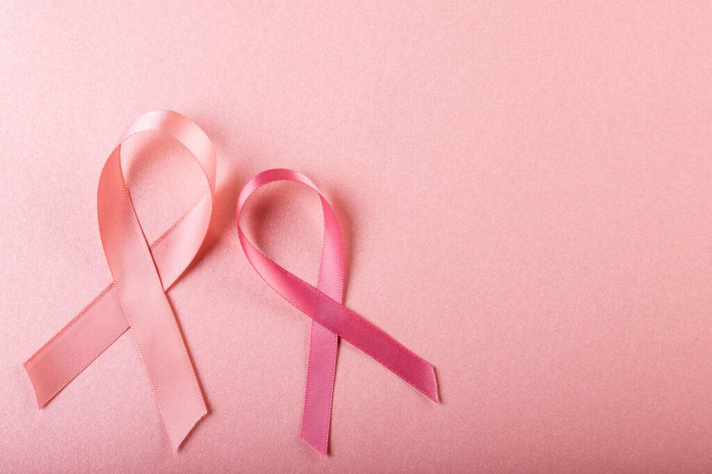 乳がんのステージ４とは？標準治療以外のアプローチも解説
