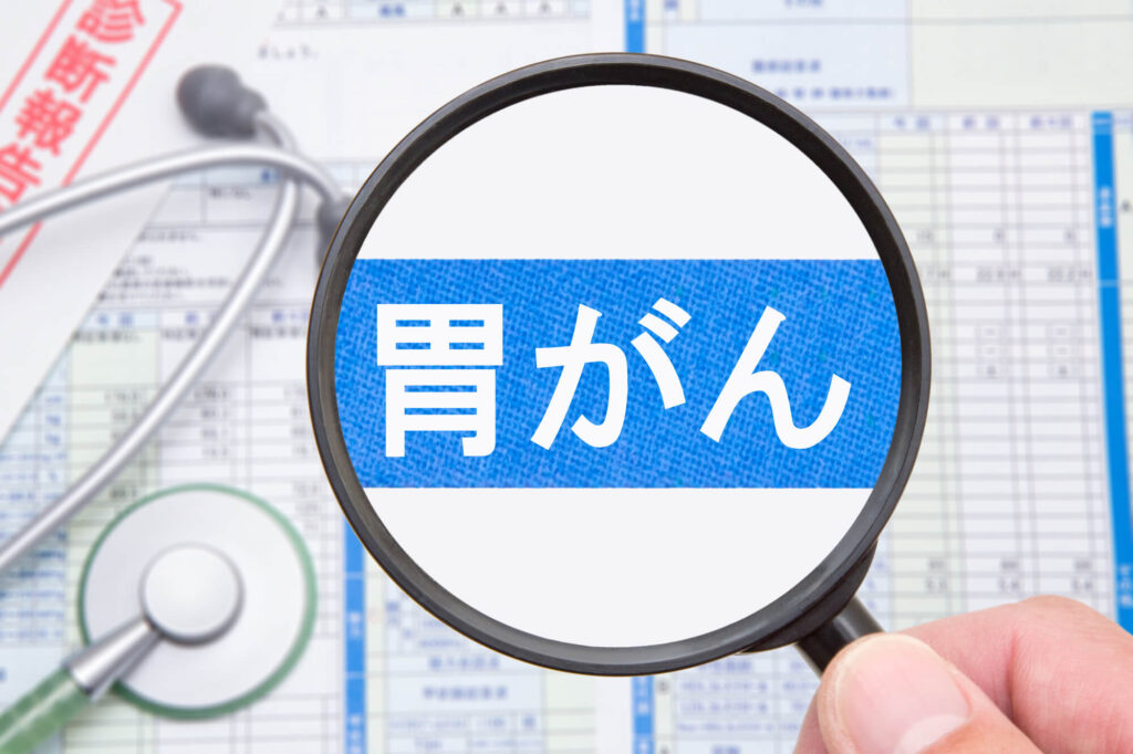 胃がん末期とは？ステージ4の基本知識