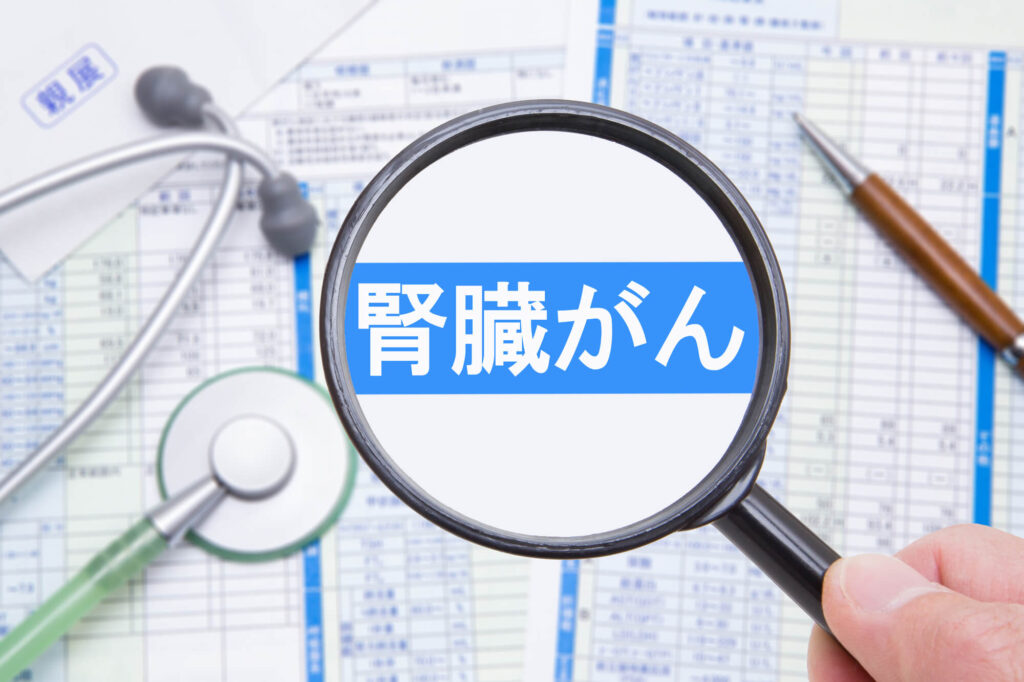 腎臓がんの末期とは